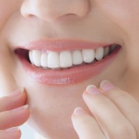 メタルフリーセラミック治療